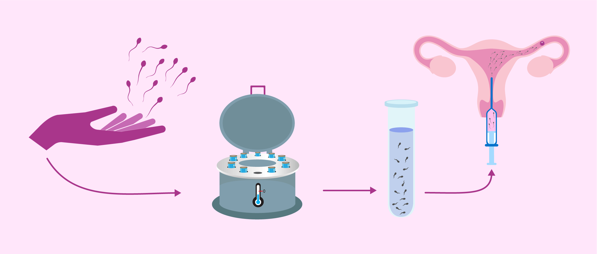 Vinegar reccomend lesbian artificial insemination in ohio