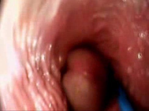 Earth E. reccomend Penis vagina sex video