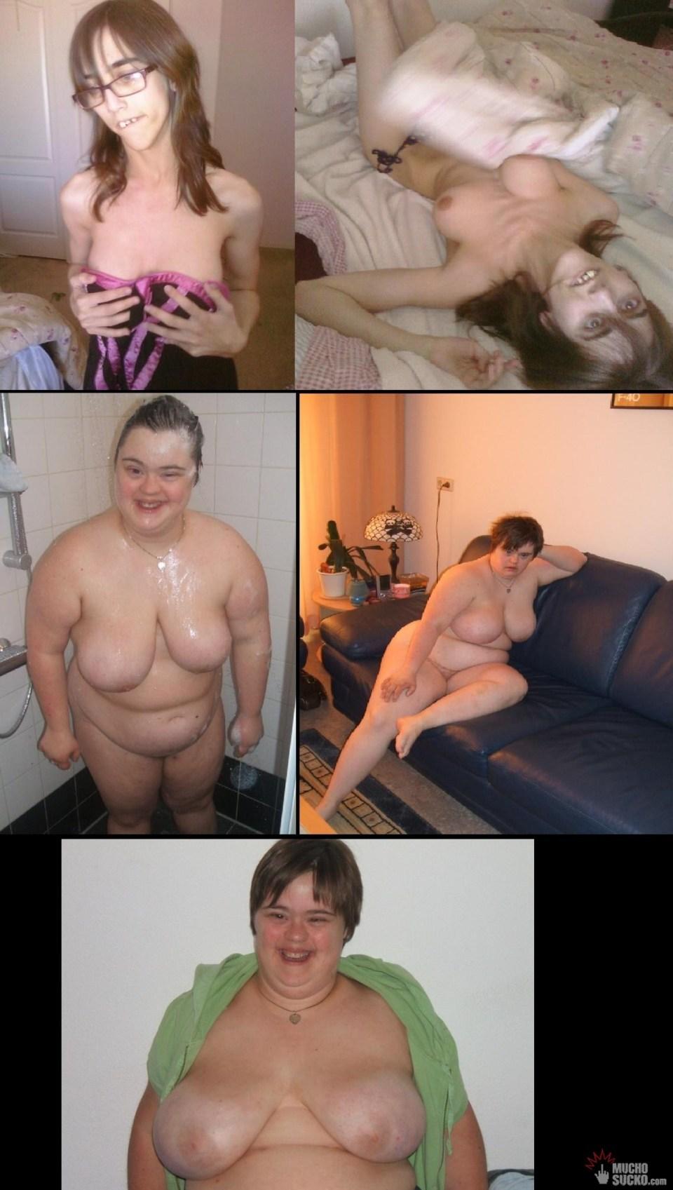 Naked retarded girl pics