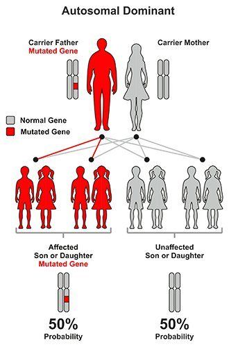 best of Onset mellitus Mature diabetes