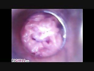 best of In medical Camera pussy