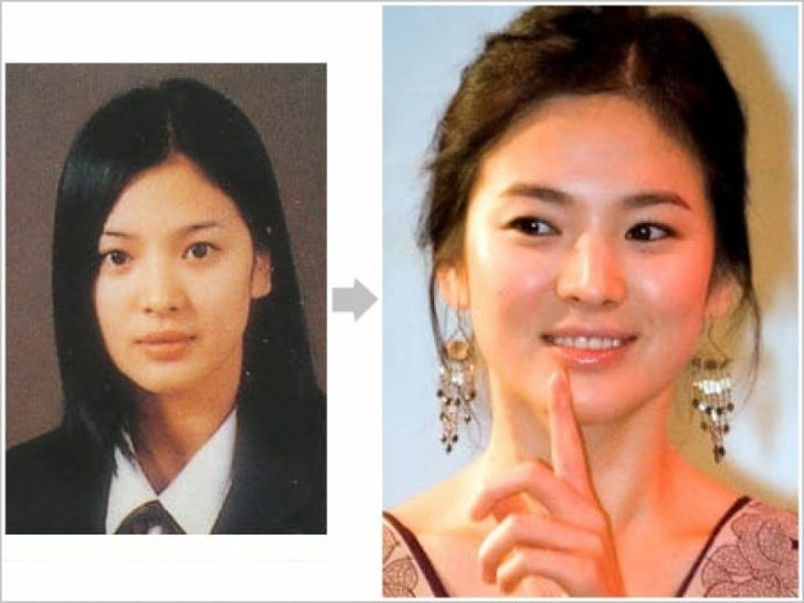 best of Celebrities surgery Asian with plastic