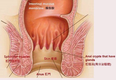 Field G. reccomend Dry skin on the anal