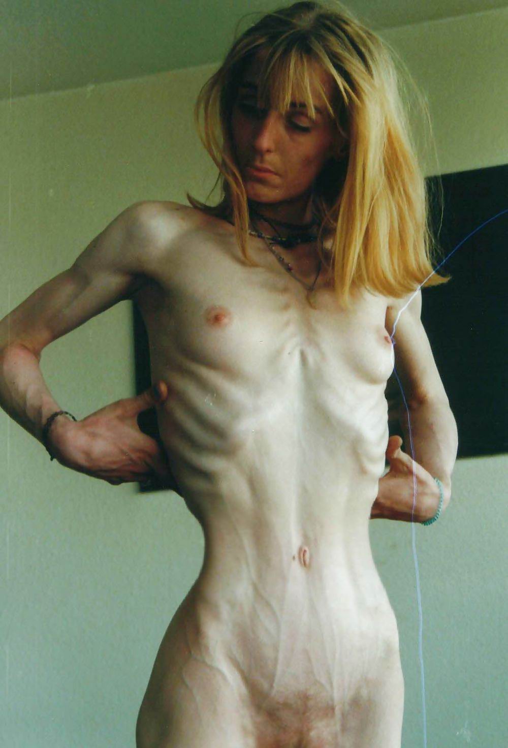 Salty reccomend naked anorexic hairy teen